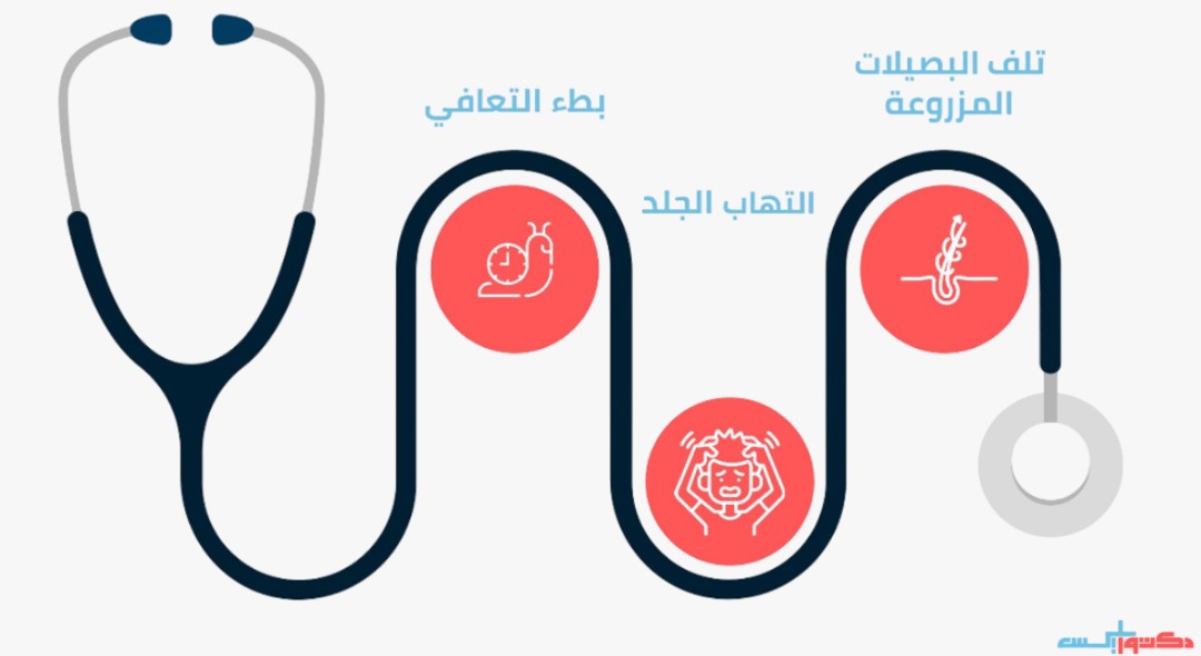 المخاطر المحتملة للسجود المبكر بعد عملية الزراعة