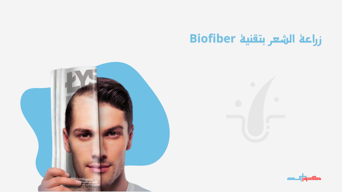 زراعة الشعر بتقنية Biofiber
