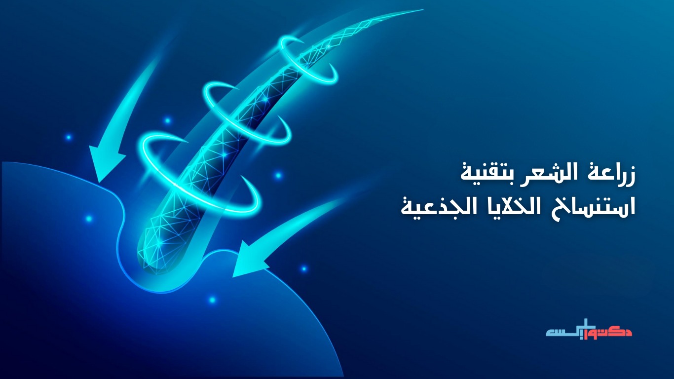 زراعة الشعر بتقنية استنساخ الخلايا الجذعية