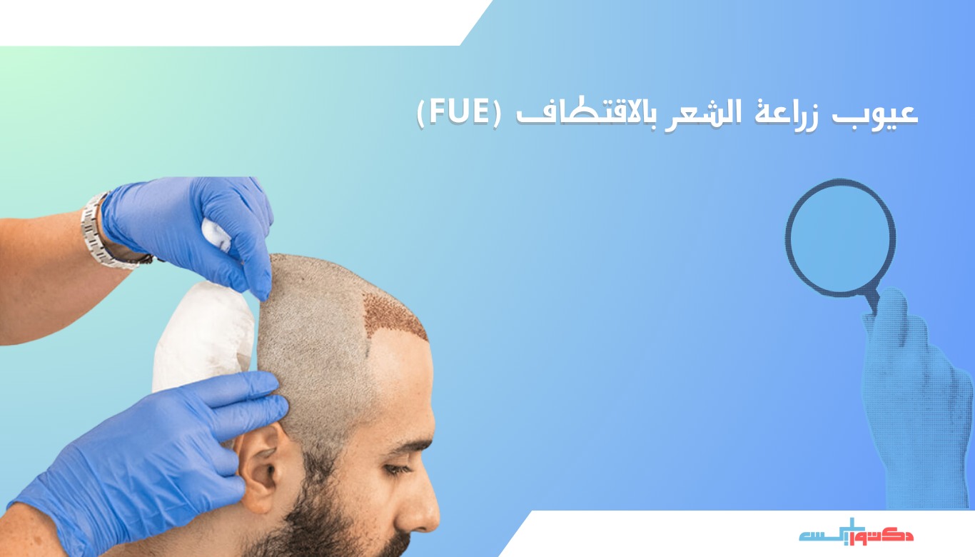 عيوب زراعة الشعر بالاقتطاف (FUE)