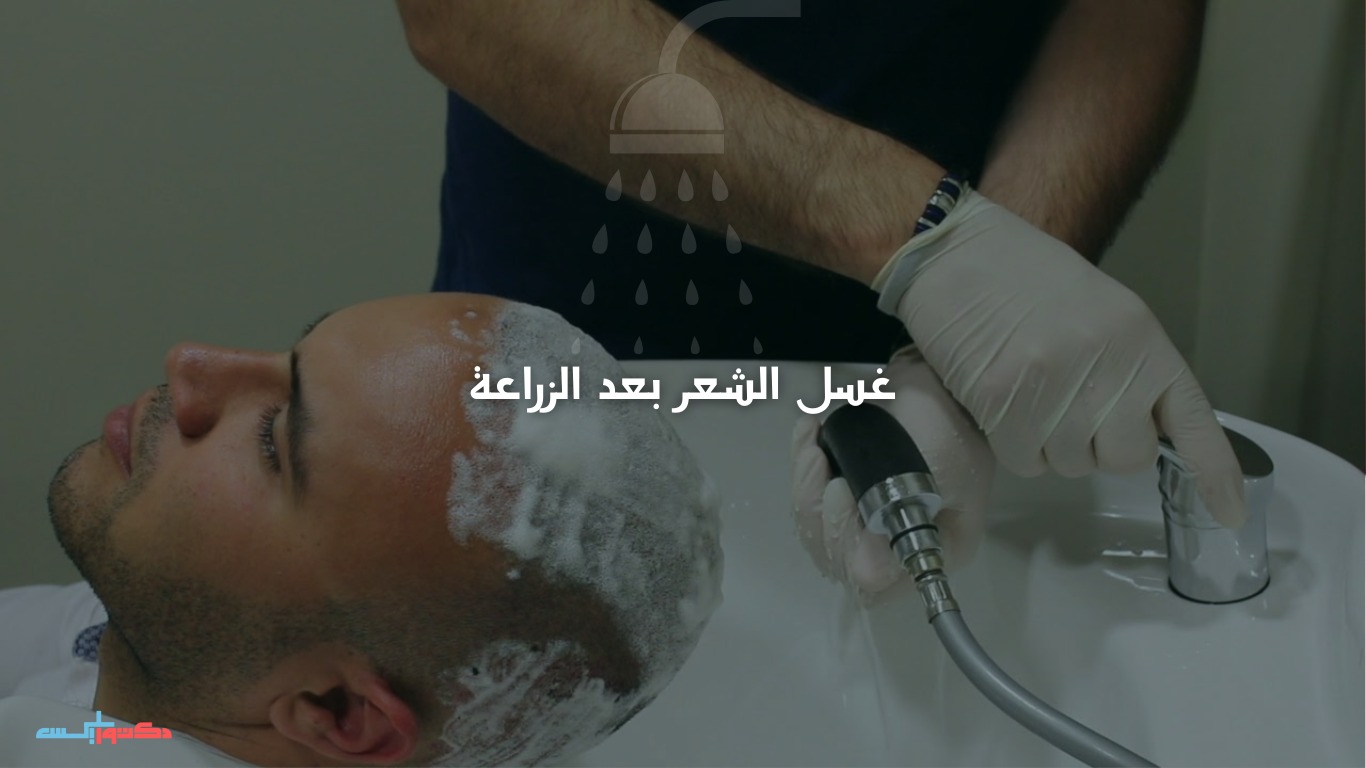 غسل الشعر بعد الزراعة