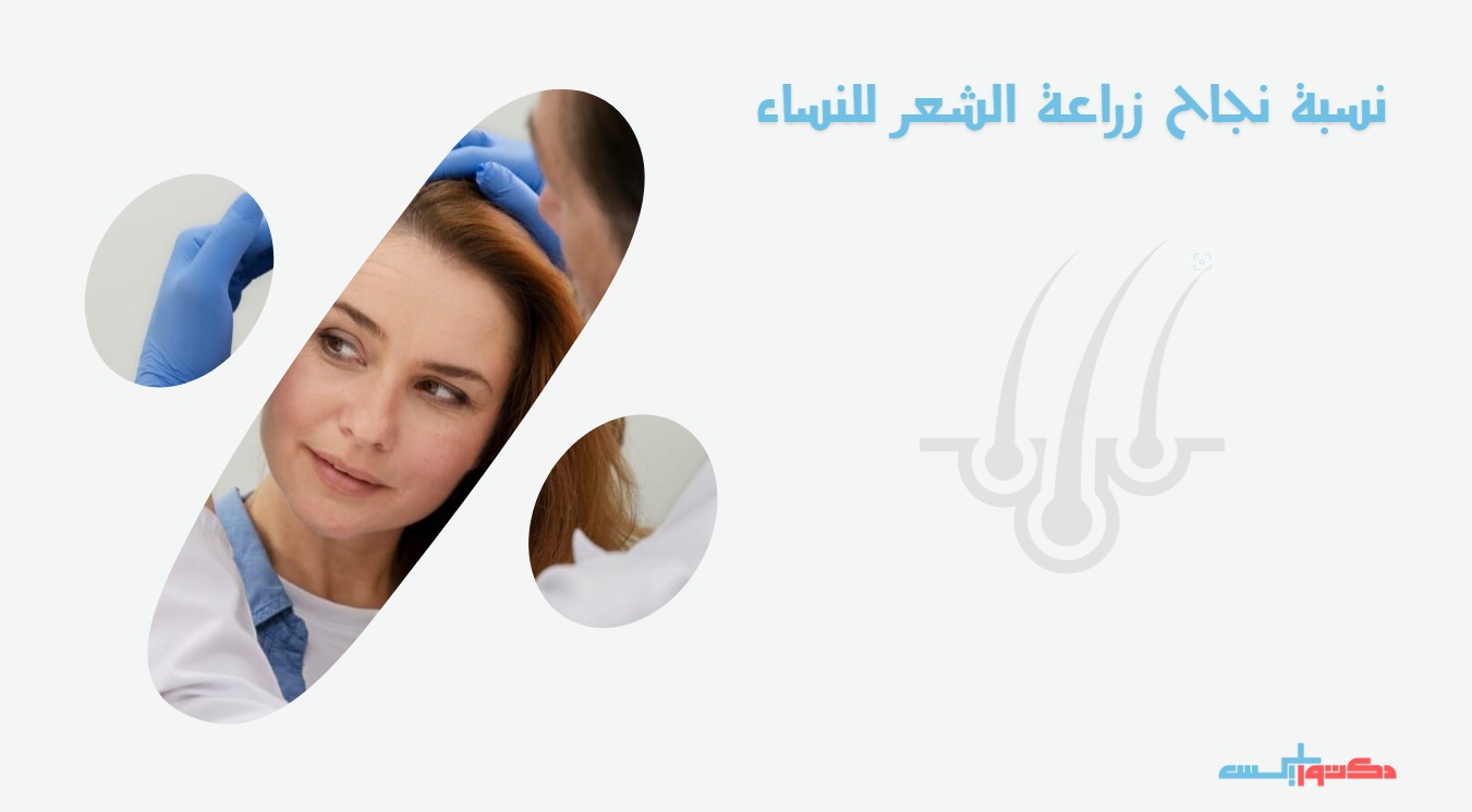 ماهي نسبة نجاح زراعة الشعر للنساء