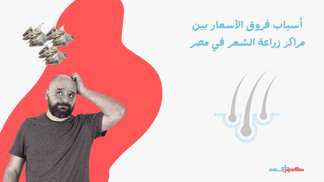 أسباب فروق الأسعار بين مراكز زراعة الشعر في مصر